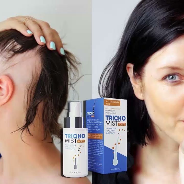 Overview of trichomist forte opinie
